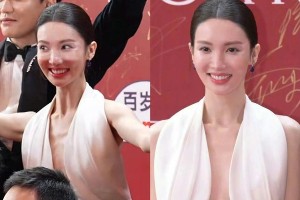 金晨整容过度引争议：面部僵硬美感全无